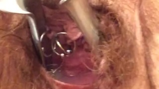 Speculum removal push, see deep inside mature MILF BBW gynecology medical 