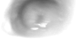 The Storm Before The Calm: Internal camera only.