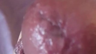 Afternoon stroke pt 1