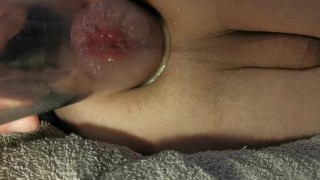 Anal pump and juicy rosebud