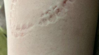 Biting Part 1