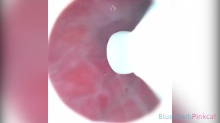 CAMERA INSIDE VAGINA AFTER INTERNAL CREAMPIE - ส่องกล้องดูอสุจิในช่องคลอด