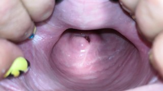 Cervix close up [4k]