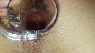 Trying To Look In My Hole - Speculum