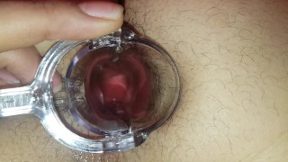 Trying To Look In My Hole - Speculum