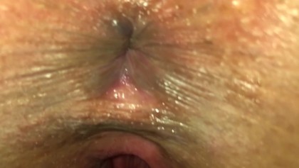 Anal Penetration Close Ups - Close Up Anal Porn Videos | YouPorn.com