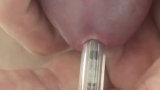 Penetration uretre