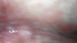 ENDOSCOPE