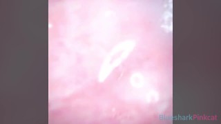 Camera inside Vagina after internal Creampie EP2 - ส่องกล้องในหีหลังแตกใน