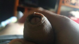 Peeling back foreskin