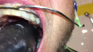 Horny deepthroat full of spit with braces and double headgear