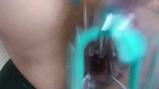 Masturbating with a speculum