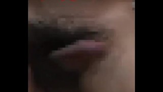 Penis(Mosaic)