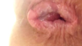 Gaping fist hole