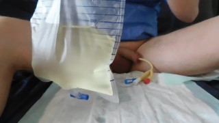 bladder lavage, 3-way catheter