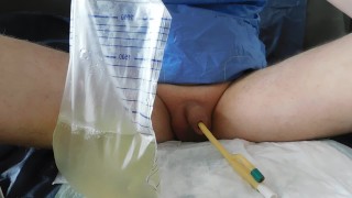 filling the bladder with an inserted catheter CH 28FR