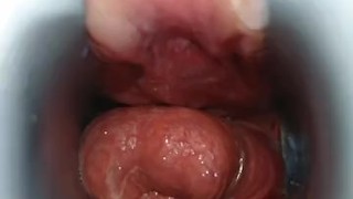 アナル内部丸見え　クスコで拡張