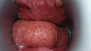 アナル内部丸見え　クスコで拡張