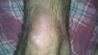 My Stumps