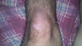 My Stumps