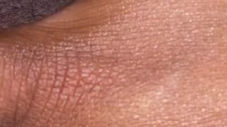 A HAIRY CLOSE UP
