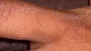 A HAIRY CLOSE UP
