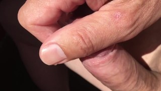 Eichelmassage