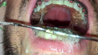 new horny deepthroat after pissing on my braces