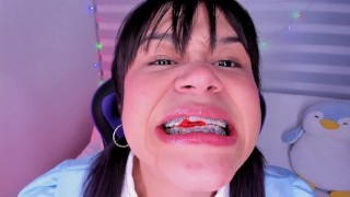 Lila Jordan swallows a lot gummy bears