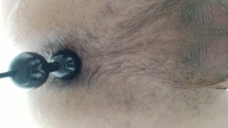 屁眼痒痒了