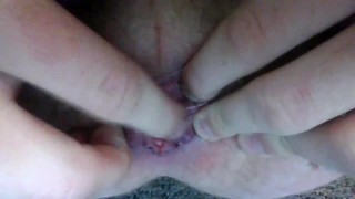 My cute little prolapsing asshole lips squeezing down and on the tip of your massive cock