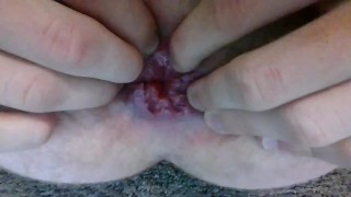 My cute little prolapsing asshole lips squeezing down and on the tip of your massive cock