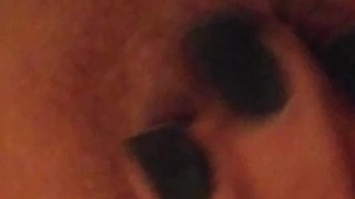 Prolapse play closeup