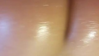CULO ACEITOSO