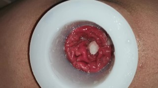 Anal Hollow Plug huge gape