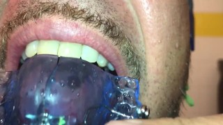 New Braces retainer and Twinblock with headgear for new aventures