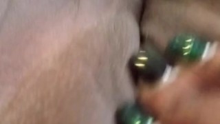 The button