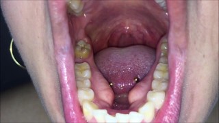 Toothpick and mouth check (Demo version)