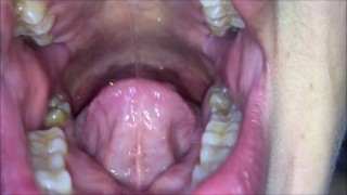 My morning breath and white tongue (Demo version)