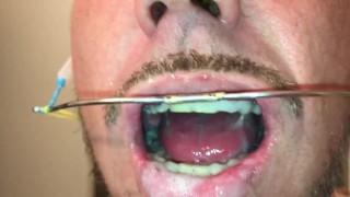 self facial on my braces and play with my cum