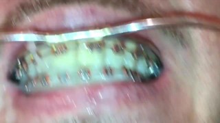 self facial on my braces and play with my cum