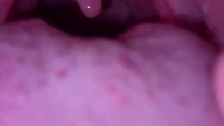  throat gagging