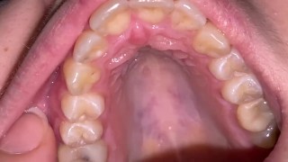 Dental examination. Teeth tour