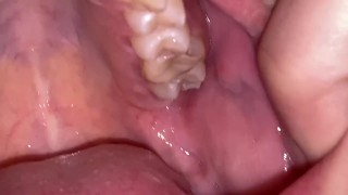 Dental examination. Teeth tour