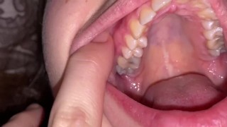 Dental examination. Teeth tour