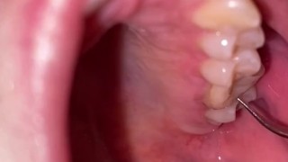 Ultrasonic teeth cleaning. Teeth fetish.