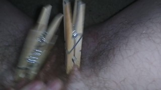 Genital Clamped Pre Op Trans Man, Clamped Lips