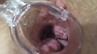 Mature lesbians play in a gynecologist, open the vagina with a medical dilator, examine the cervix.
