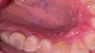 Mouth tour. Uvula and teeth 