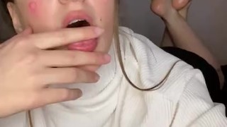Drooling and oil feet